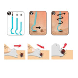 Bye Bugs - Trousse de base - Extraction des tiques